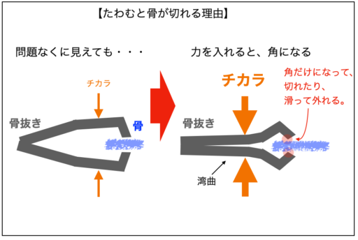 【解説図】たわむと骨が切れる理由